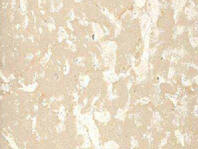 BOTTICINO FIORITO slabs tiles project