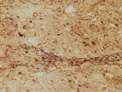 CHIAMPO PERLATO slabs tiles project